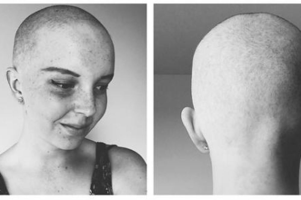 GRICKANJE GRUDI JE BILO BOLNO: Eva je pobedila RAK, a sada je otkrila kako je bolest uticala ne njen život (FOTO)