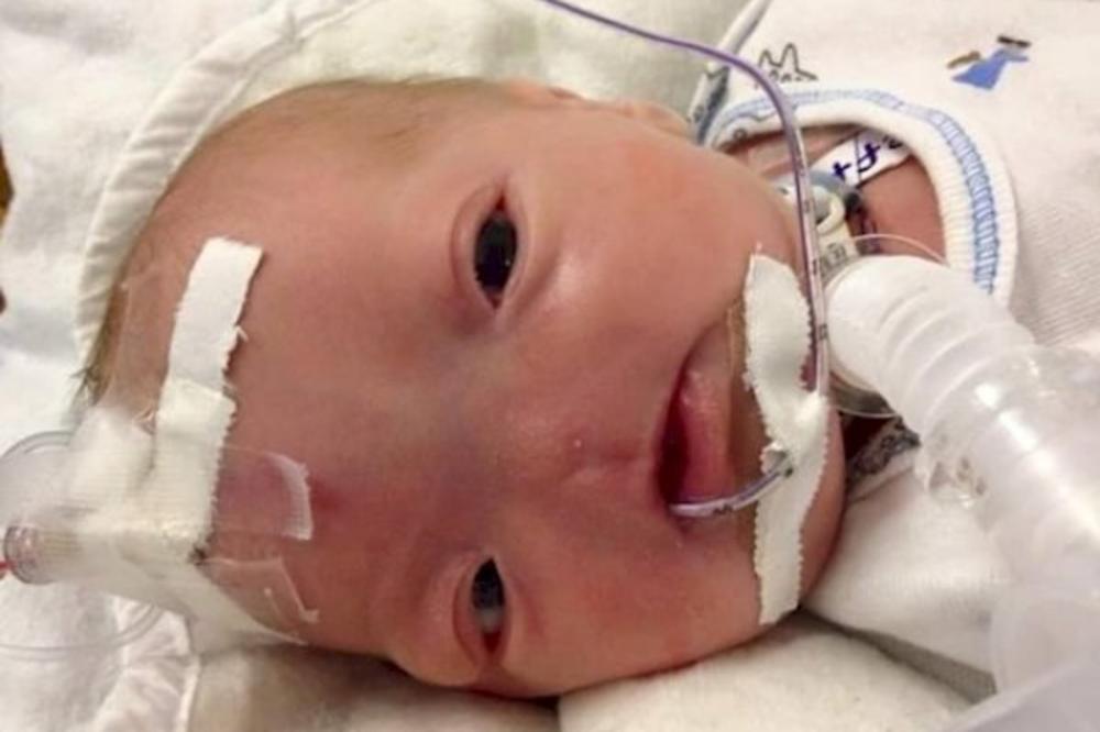 DEČAK (3) SE RODIO BEZ NOSA: Roditelji i maleni su prošli kroz pravi pakao, a on danas izgleda OVAKO! (FOTO)