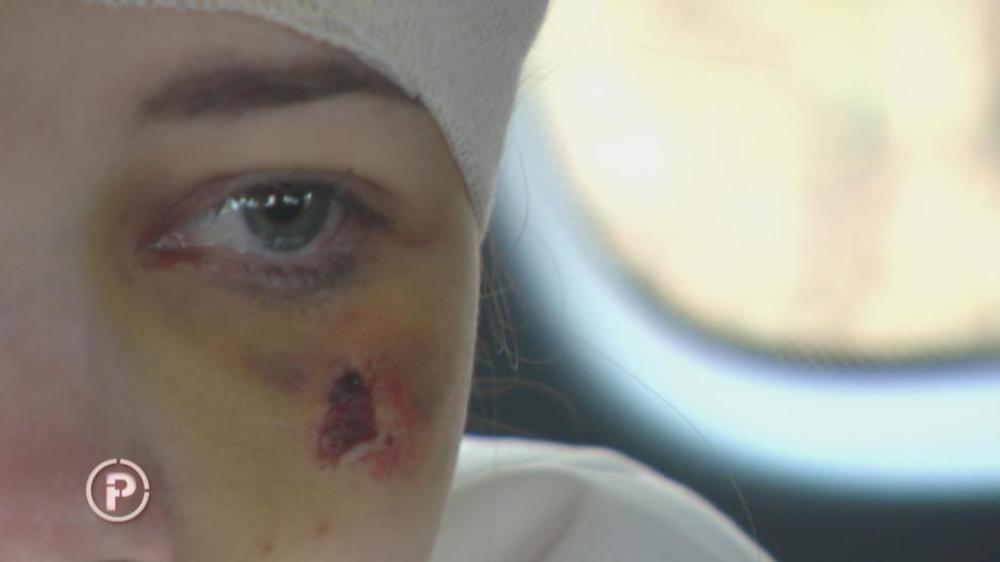 Zadobila je teške povrede 