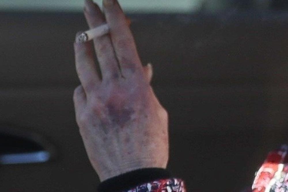 ŠOKANTNA FOTOGRAFIJA ZVEZDE KOJA SE DVA PUTA IZBORILA SA KARCINOMOM KOŽE: Slavnoj glumici se VRATILA BOLEST?!