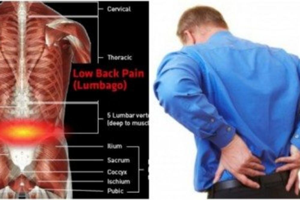 EVO KAKO SE REŠITI BOLA U LEĐIMA PRIRODNIM PUTEM: Ova biljka odnosi bol u 95% slučajeva!