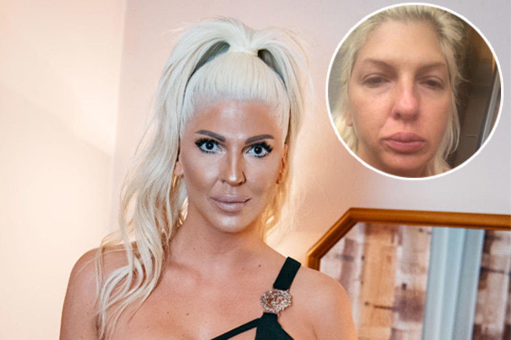 DA LI JE OVO KARLEUŠINO NAJGORE IZDANJE IKADA?! Otečena diva s podočnjacima! Ni traga onoj JK koju znamo (FOTO)