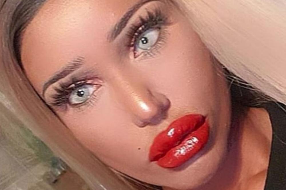 OVAKO IZGLEDA ŽENA KOJOJ SU LJEKARI ZABRANILI ESTETSKE OPERACIJE: Govore mi da sam FEJK, ali ja OVO ŽELIM (FOTO)