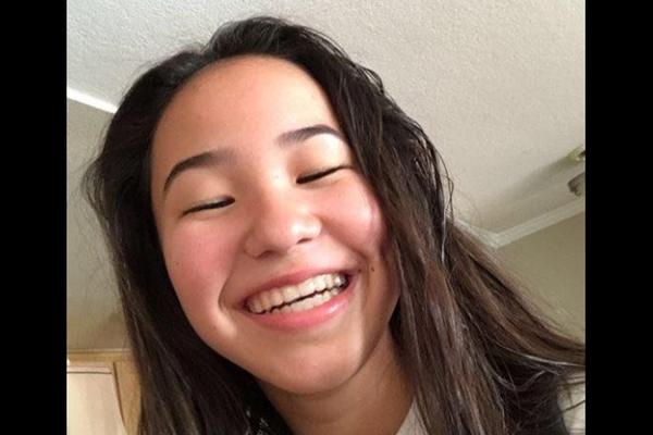 ZAMALO UMRLA ZBOG LEKA KOJI SE PRODAJE I U SRBIJI: Koža joj je izgledala kao da ima opekotine! (FOTO)