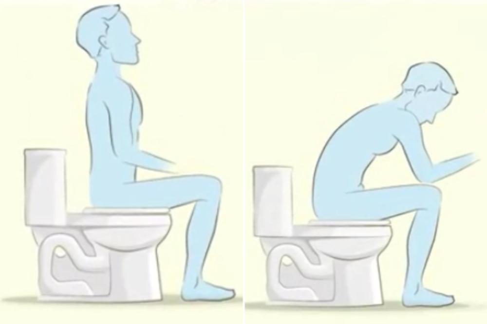 CEO ŽIVOT STE POGREŠNO SEDELI NA WC ŠOLJI: Evo kako pravilno treba da praznite creva (VIDEO)