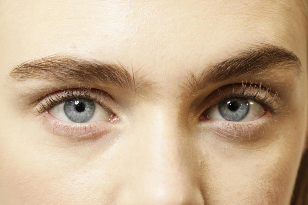 3 ZNAKA VISOKOG HOLESTEROLA SE VIDE NA TELU: Čim ih primetite uradite OVO HITNO, ne zovu ga za džabe "TIHI UBICA"