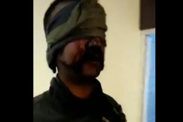 OČI SU MU VEZANE, A LICE KRVAVO: Pojavio se prvi snimak ZAROBLJENOG INDIJSKOG PILOTA u Pakistanu! (VIDEO)