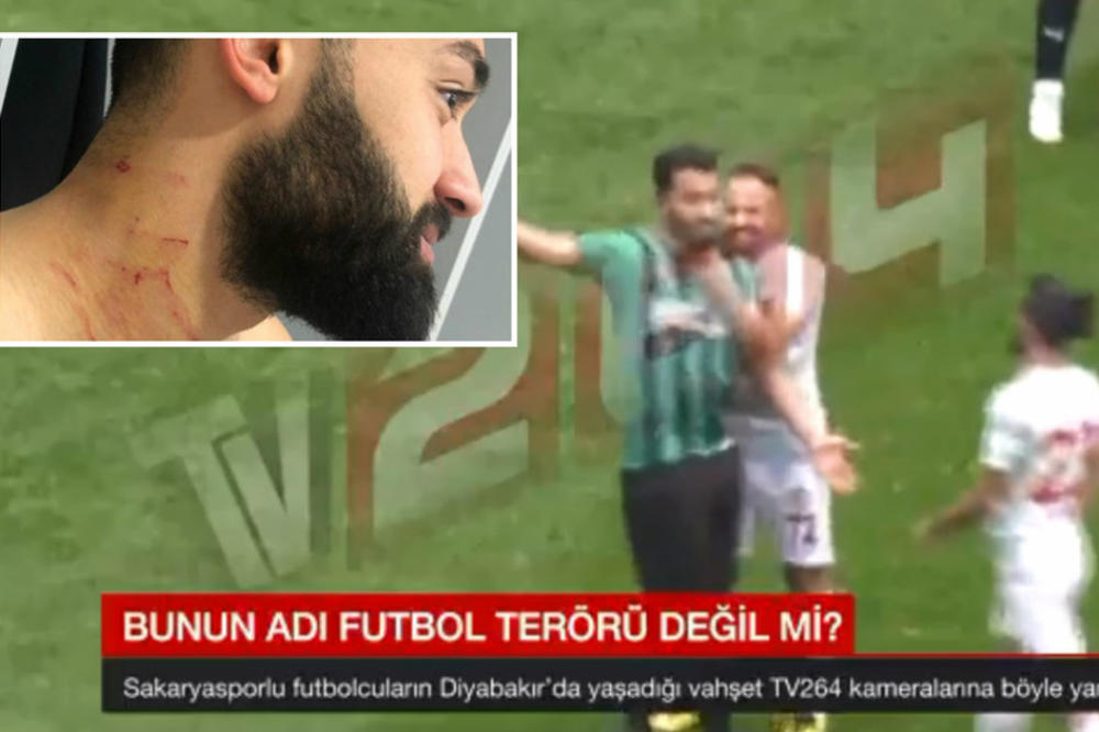 STRAHOTA U TURSKOJ: Fudbaler uneo žilet na teren i sekao protivničke igrače!