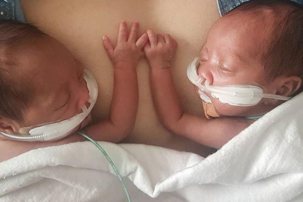 BLIZNAKINJE SU PRERANO ROĐENE, PA SU IH RAZVOJILI: Ono što su bebe uradile kada su se opet srele rastopiće vam srce