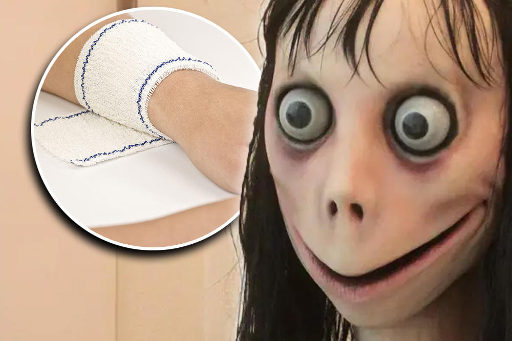 DRUG MOG SINA JE POKUŠAO DA PRESEČE VENE POSLE IGRANJA IGRICE MOMO! Srpkinja u panici, roditelji takođe (FOTO)