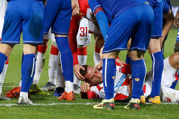 UMALO DA OSTANE BEZ OKA: Krvave scene na Marakani - Simić imao sreće!