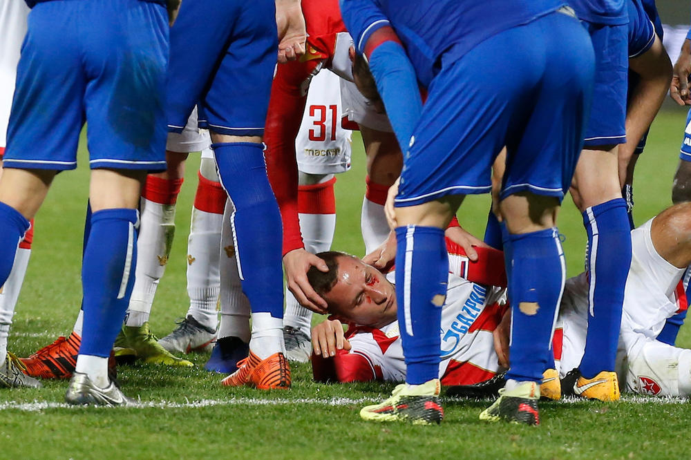 UMALO DA OSTANE BEZ OKA: Krvave scene na Marakani - Simić imao sreće!