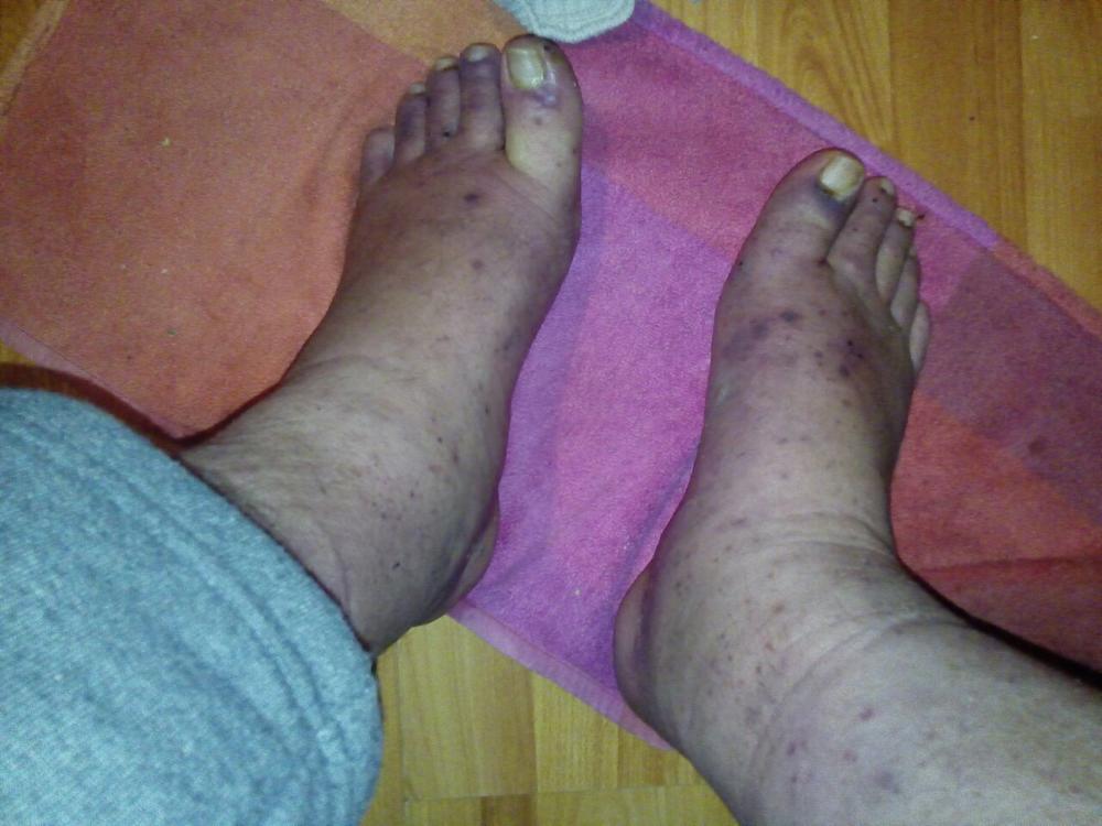 Još uvek bez jasne dijagnoze 