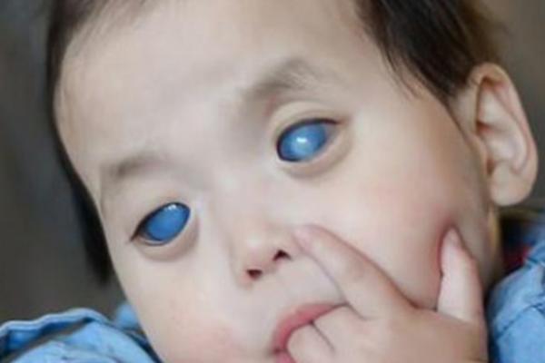 DOVOJČICU SU U SIROTIŠTU ZVALI ČUDOVIŠTEM Njena priča je pretužna, jedan par vratio je malenoj veru u ljude i život