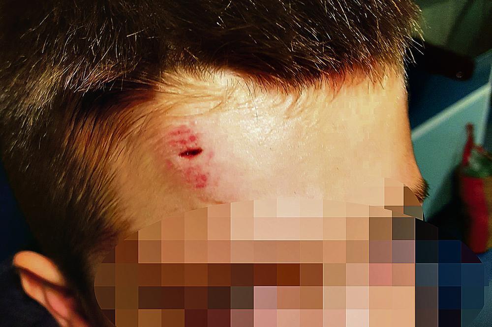 MOTKOM SILOVALI DEČAKA U ŠKOLSKOM DVORIŠTU: Vređali ga, bacali u BLATO pa SNIMALI! NEZAPAMĆEN HOROR NA VOŽDOVCU