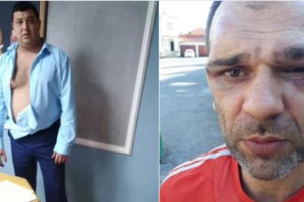 PRVI ČOVEK ŽITORAĐE IH OPTUŽIO DA SU GA TUKLI, SUD IH PUSTIO DA SE BRANE SA SLOBODE: Tuča u opštini dobija obrt