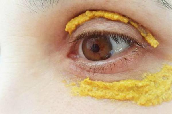 KURKUMA JE ZDRAVA, ALI NE MOŽE LEČITI TEŠKE BOLESTI