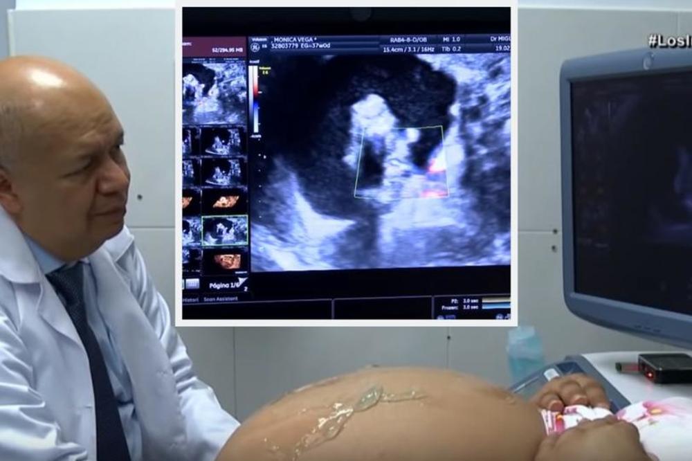 LEKAR JE NA ULTRAZVUKU PRIMETIO NEŠTO ČUDNO NA BEBI: Uskoro su saznali da u njoj ŽIVI nešto neverovatno! (VIDEO)