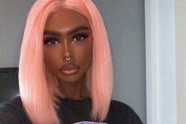 JA SAM SASVIM NORMALNA BELA DEVOJKA: Ljudi se zaprepaste kada je vide, ali nju to NE DOTIČE! (FOTO)