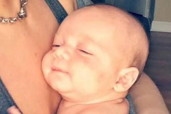 NJIHOVA BEBA JE U POČETKU IZGLEDALA SASVIM NORMALNO: Ali kada je počela da joj raste kosa, OTKRILI SU RETKU BOLEST