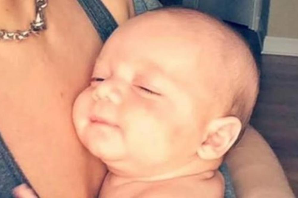 NJIHOVA BEBA JE U POČETKU IZGLEDALA SASVIM NORMALNO: Ali kada je počela da joj raste kosa, OTKRILI SU RETKU BOLEST