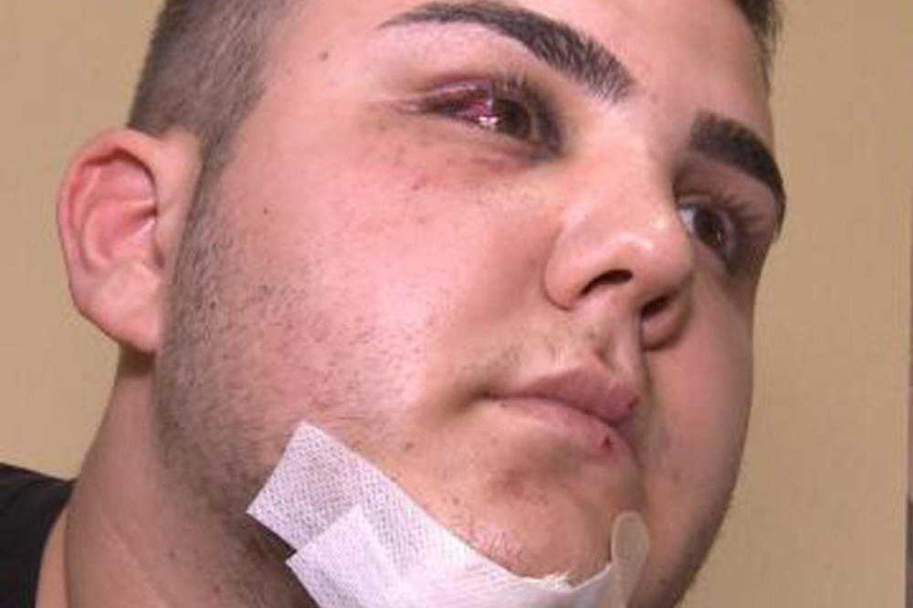 SREDNJOŠKOLAC BRUTALNO PRETUČEN ISPRED NOĆNOG KLUBA: Besomučno su ga tukli I RUKAMA I NOGAMA