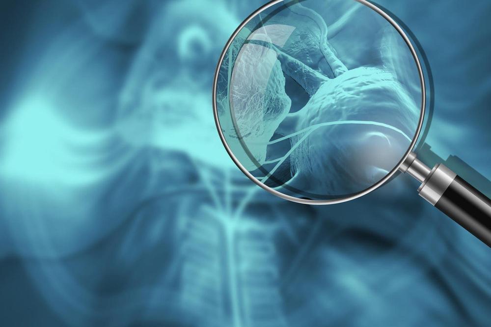 DOBRE VESTI ZA SVE KOJI BOLUJU OD OVE OPAKE BOLESTI: Pojavila se NADA!