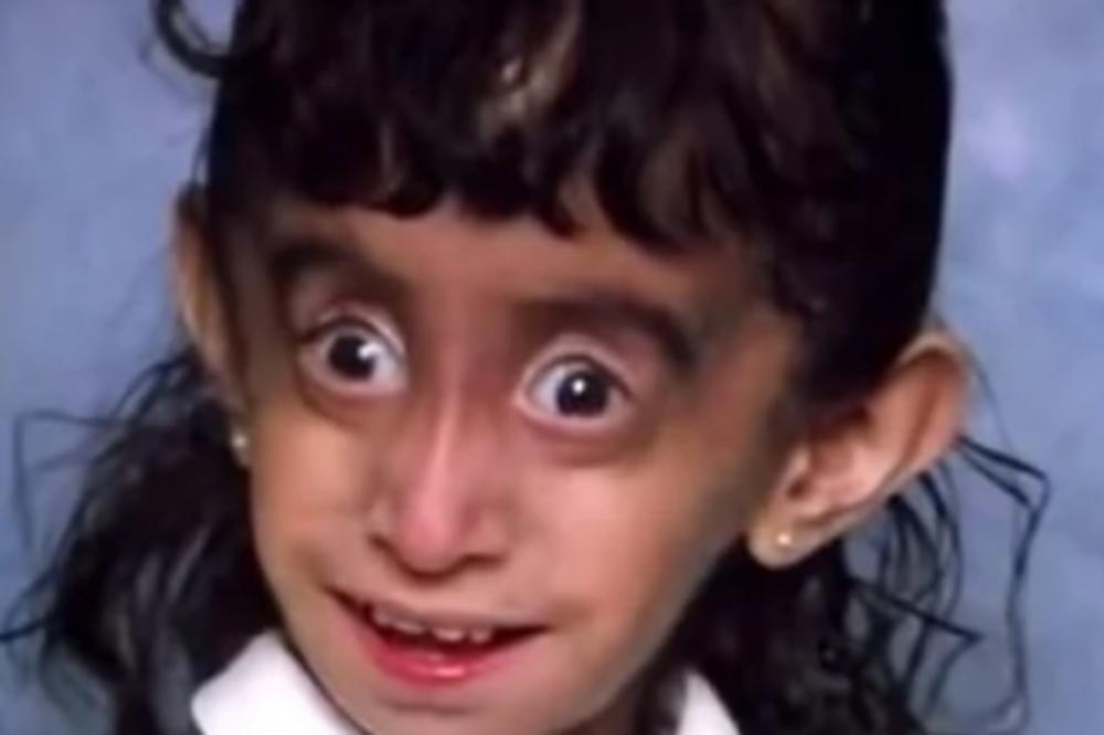 DECA SU JOJ GOVORILA DA JE NAJRUŽNIJA DEVOJČICA NA SVETU: 25 godina kasnije svima je ZAPUŠILA USTA (VIDEO)