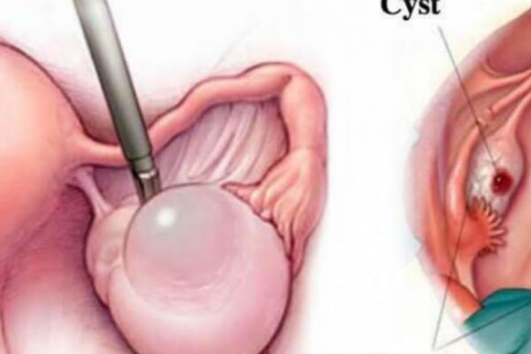 JEZIVO! Ovo se događa u ženskom telu ukoliko nema nedelju dana ODNOS! TELO NE MOŽETE PREVARITI