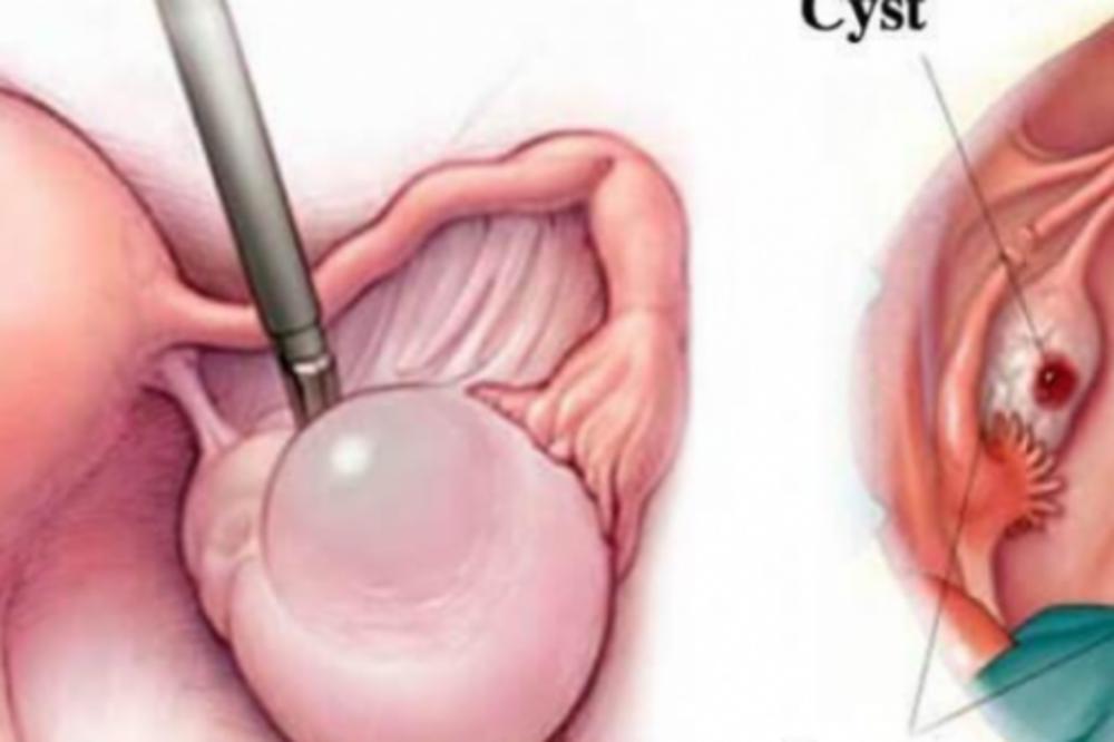 JEZIVO! Ovo se događa u ženskom telu ukoliko nema nedelju dana ODNOS! TELO NE MOŽETE PREVARITI