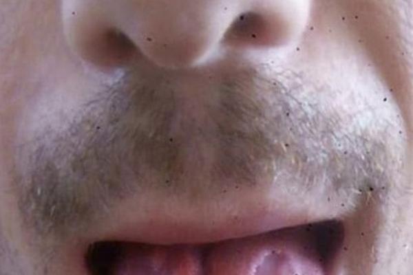 OVAJ ČOVEK JE PIO 6 ENERGETSKIH PIĆA DNEVNO I UNIŠTIO SEBE: Kada je lekarima pokazao jezik, ZGROZILI SU SE! (FOTO)