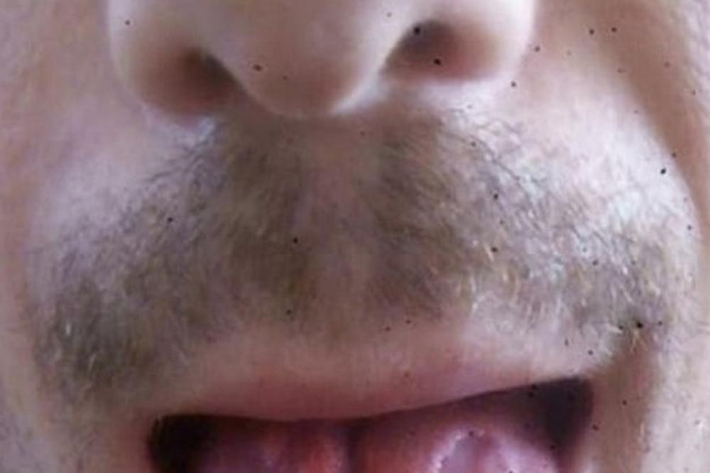 OVAJ ČOVEK JE PIO 6 ENERGETSKIH PIĆA DNEVNO I UNIŠTIO SEBE: Kada je lekarima pokazao jezik, ZGROZILI SU SE! (FOTO)