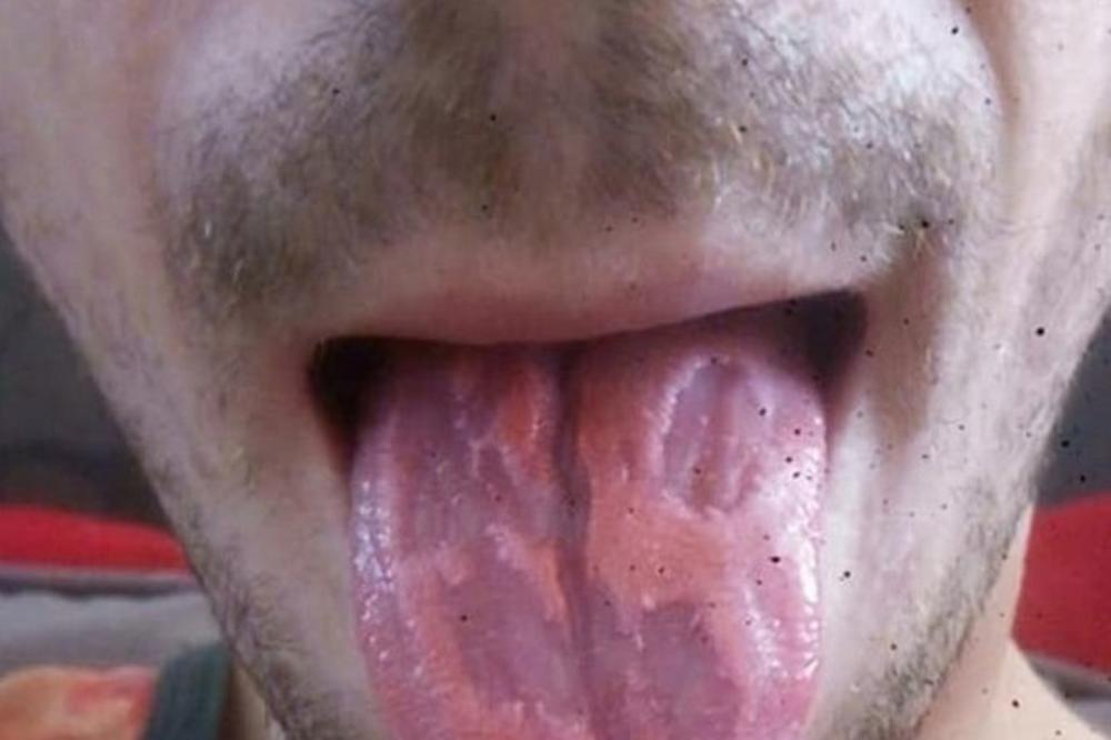 BOJA JEZIKA GOVORI O VAŠEM ZDRAVLJU VIŠE NEGO ZDRAVSTVENI KARTON: Ako primetite ovu PORMENU otmah trčite LEKARU