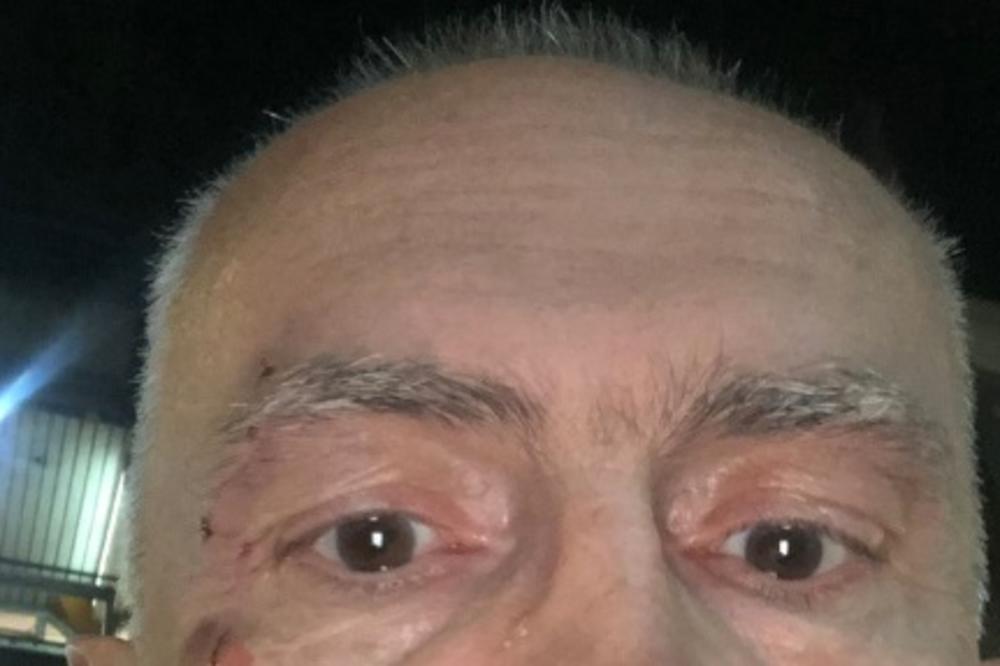 ŠABIĆ KRVAVE GLAVE I UNEZVERENIH OČIJU: Bivši poverenik okačio uznemirujuću fotku, NEKO GA JE PRETUKAO? (FOTO)