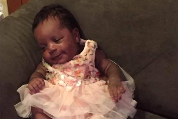 VEĆ DRUGOG DANA ŽIVOTA BEBE, PRIMETILI SU DA NEŠTO NIJE U REDU: Jedini lek za nju je da joj odstrane pola mozga...