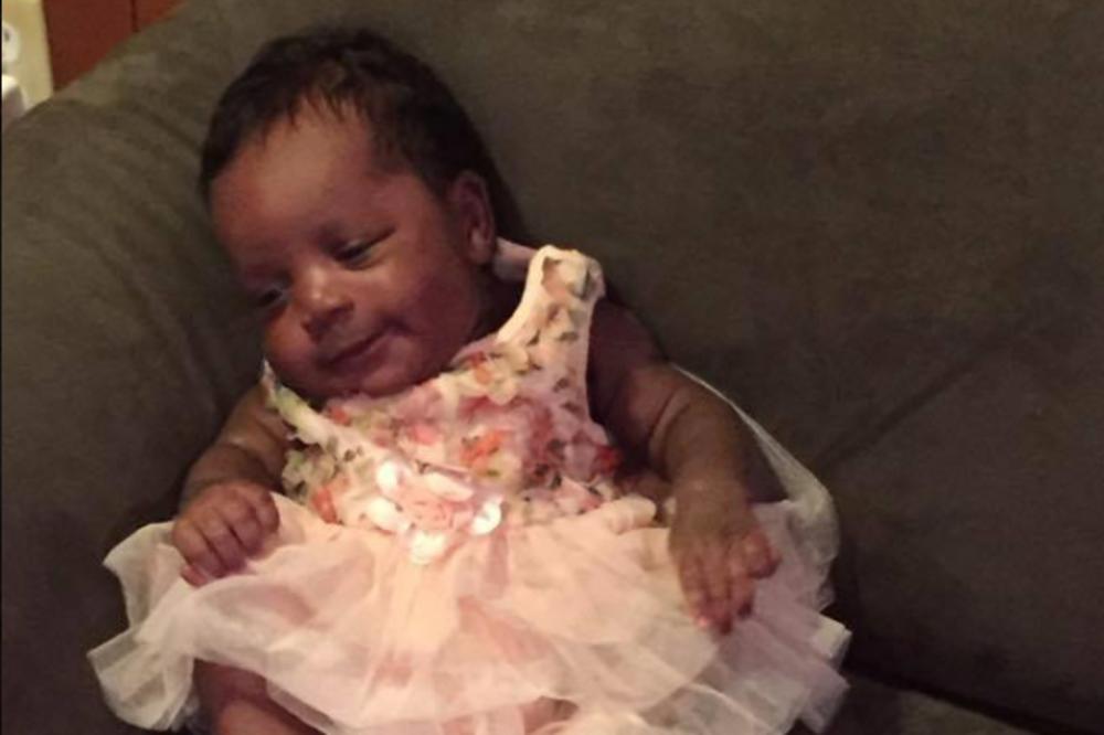 VEĆ DRUGOG DANA ŽIVOTA BEBE, PRIMETILI SU DA NEŠTO NIJE U REDU: Jedini lek za nju je da joj odstrane pola mozga...