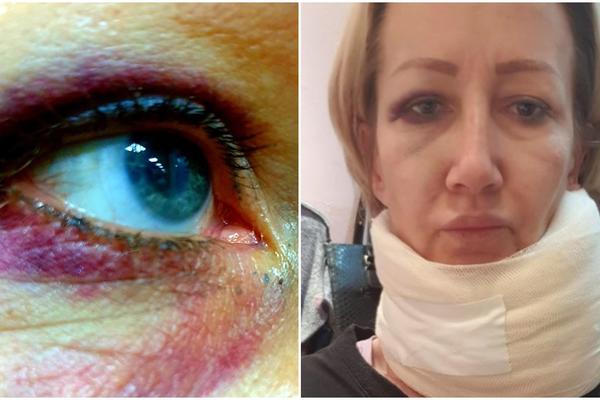 TUKAO ME JE 12 SATI, NE ZNAM KAKO ME NIJE UBIO! Ispovest ADVOKATICE koju je PREBIO KOLEGA! BIO JE MRTAV PIJAN