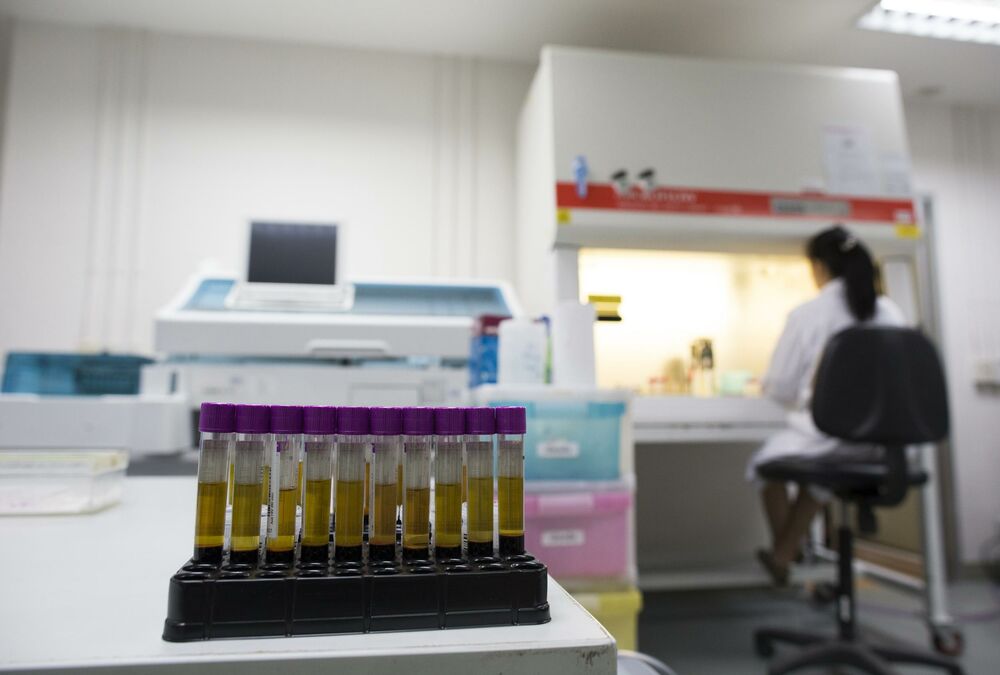 Uzorci krvi, Krv, Laboratorija