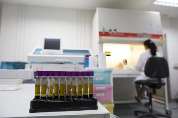 OVO JE ZDRAVO KAO DREN, ALI AKO PRETERATE MOŽETE DA UMRETE: Hitno otkriće naučnika, DOBRO PRIPAZITE!