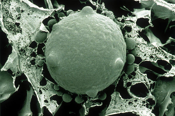 NAJOPASNIJA GLJIVICA IMA MOĆ DA IZBRIŠE CELE VRSTE IZ ISTORIJE: Prenose je i ljudi, a oni su NAJVIŠE NA UDARU