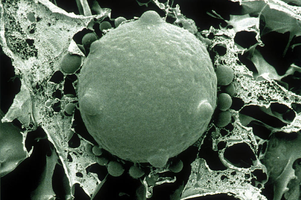 NAJOPASNIJA GLJIVICA IMA MOĆ DA IZBRIŠE CELE VRSTE IZ ISTORIJE: Prenose je i ljudi, a oni su NAJVIŠE NA UDARU