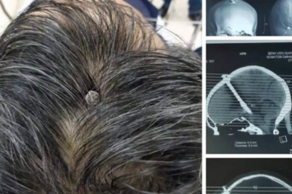 OTIŠAO JE KOD LEKARA JER GA JE STRAŠNO BOLELA GLAVA: Doktori su SE ŠOKIRALI kada su videli SNIMAK! (FOTO)