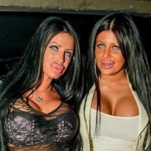 VIŠE NIJE KRALJICA SILIKONA! Od PAČIJIH USTA, GIGANTASKIH GRUDI I PLAVIH OČIJU NEMA NIŠTA! Promena je šokantna