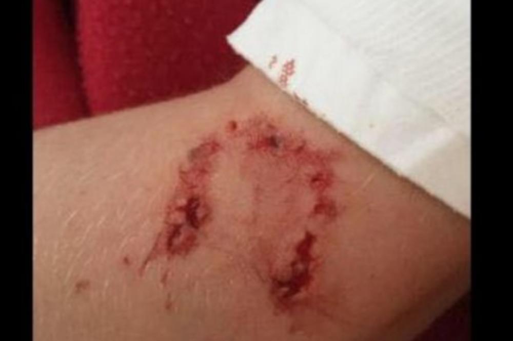 USRED NOĆI JE ČUO ĆERKICU KAKO ŠAPATOM MOLI ZA POMOĆ: Ono što je video na NJENOJ RUCI mu je skratilo život! (FOTO)