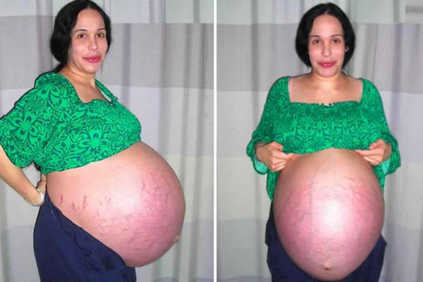 RODILA JE OSMORKE, SNIMILA FILM ZA ODRASLE PA SE POVUKLA: Ona posle 10 godina izgleda OVAKO! (FOTO)