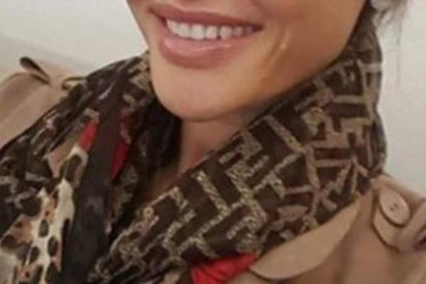 JEZIV PRIZOR! SRPSKOJ PEVAČICI ŽIVOTINJA UNAKAZILA NOGU: Rana joj se inficirala, SVA JE U KRVI I GNOJU! (FOTO)