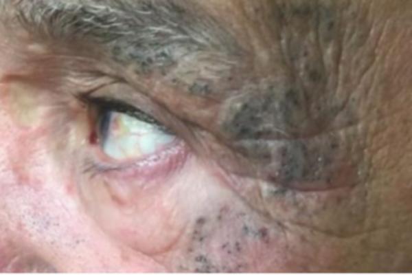 Lice mu je skoro eksplodiralo od silnih tačkica, a sve zbog nečega što većina ima! (VIDEO)