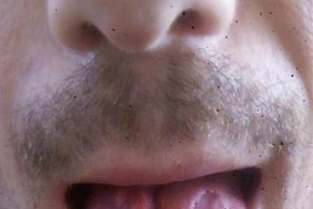 Učitelj je pio 6 energetskih pića dnevno, pa je POGLEDAO U SVOJ JEZIK: Ako ih pijete, DESIĆE VAM SE OVIH 8 STVARI!