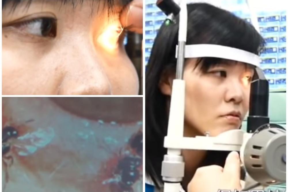 U OKU DEVOJKE ŽIVELE 4 PČELE: Hranile se devojčicinim SUZAMA, dok ih lekar nije izvukao NAPOLJE! (VIDEO)