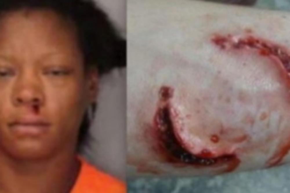 ŽENA UJELA POLICAJCA DOK JU JE HAPSIO:Analizom njene PLJUVAČKE otkrivena je STRAŠNA ISTINA! (VIDEO)